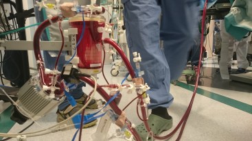 ecmo2